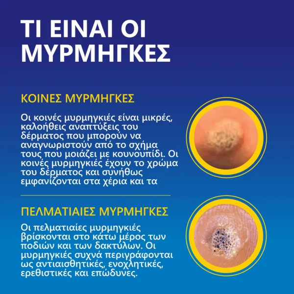 Σύστημα Αφαίρεσης Μυρμηγκιών Freeze Away Max για χέρια και πόδια - Image 5
